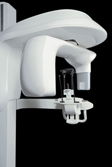 An image of a CS 9300 scanning system